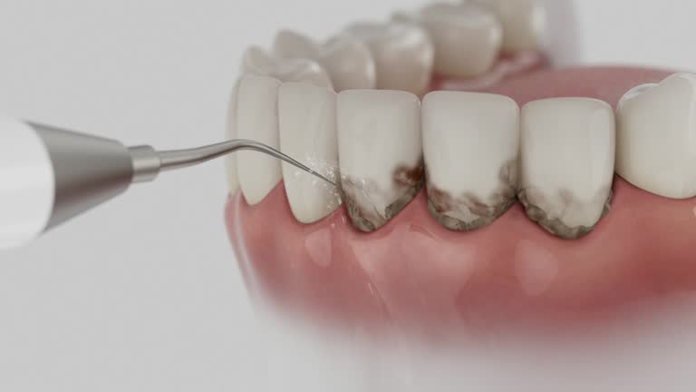 Trusted Dental Crowns And Bridges service in Dunnavant, AL - Dentist Open Now